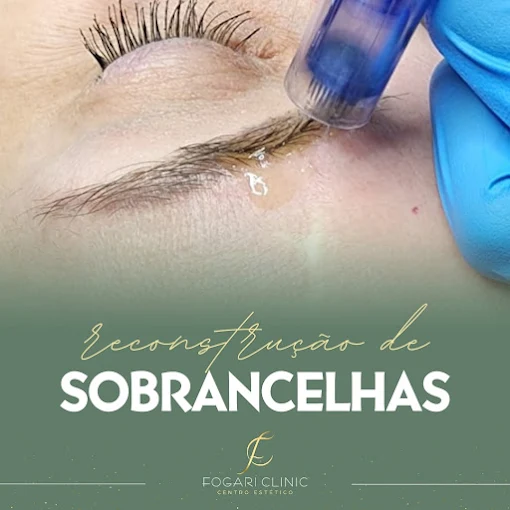 Reconstrução de Sobrancelhas