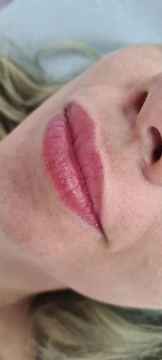 Resultado de micropigmentação labial, caso 3